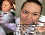 #glutathione #healthandbeauty #cosmetic #beauty #health #lifestyle -- Nutrition & Food Supplement -- Makati, Philippines