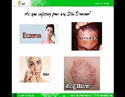 Psoriasis, skin diseases, acne, eczema, an-an, ring worm. dermatitis -- Networking - MLM -- Metro Manila, Philippines