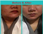 Kojic set is a new set of PSCF by Dr. Alvin -- Beauty Products -- Metro Manila, Philippines