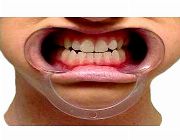 cheek retractor, mouth opener, dental, braces -- Dental Care -- Imus, Philippines