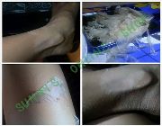 peeling oil, scar remover, melasma remover, dark skin remover, stretchmarks remover, yellow peeling oil, green peeling oil, cherry peeling oil, whitening, lightening, bleaching, soap, cream, lotion, meet-up, shipment, wholesale, retail -- All Health and Beauty -- Cavite City, Philippines