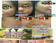 pimple trearment, night gel, acne, organic -- Beauty Products -- Caloocan, Philippines