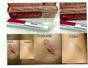 scar remover -- Natural & Herbal Medicine -- Bacoor, Philippines