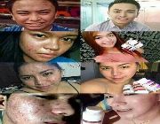 #luxxewhite #glutathionecapsules #whitening -- Nutrition & Food Supplement -- Metro Manila, Philippines