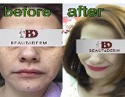 beautederm, skincare, pimple cream, acne cream, beauty set, skin care set, toner, anti-aging -- All Health and Beauty -- Metro Manila, Philippines