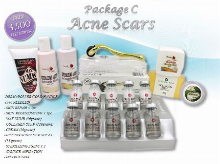 acne scar treatment, -- Distributors -- Bulacan City, Philippines