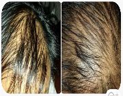 Hair grower, hairgrower, stop hairloss, hairloss, bald, cure baldness, hairloss, grow hair, regrow hair, hair growth, stop baldness, baldness, dandruff, alopecia, alopecia Areata -- Natural & Herbal Medicine -- Iloilo City, Philippines
