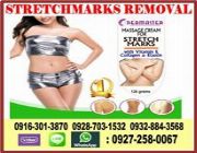 stretchmarks lotion, stretchmarks, stretchmarks removal -- Beauty Products -- Manila, Philippines