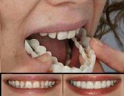 Dental teeth -- Distributors -- Metro Manila, Philippines