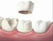 Cheap Dental Clinic in Manila,Best Dentist in Manila,Manila Dental,dental clinic in caloocan,Filipino Dentists -- Medical and Dental Service -- Metro Manila, Philippines