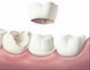 dental services price list Philippines , Best Dental Clinic in Manila ,Dental Implants Manila -- Doctors & Clinics -- Quezon City, Philippines