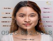 all natural super foods for acne whitening lightening pores wrinkles anti aging -- Beauty Products -- Quezon City, Philippines