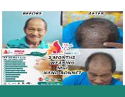 nano hood, nano bonet, nano topi, nano pilgrim cap, hair grower, prevent hair loss, -- Hats & Headwear -- Metro Manila, Philippines