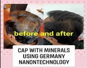 nano hood, nano bonet, nano topi, nano pilgrim cap, hair grower, prevent hair loss, -- Hats & Headwear -- Metro Manila, Philippines