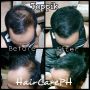 toppik hair building fibers caboki xfusion minoxidil hair loss regrow regro, -- Nutrition & Food Supplement -- Metro Manila, Philippines