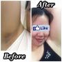 whitening, whitening and antiaging, bleaching set, navarros bleach, -- Beauty Products -- Metro Manila, Philippines