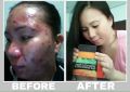 skin whitening, skin whitening soap, skin white, -- Beauty Products -- Metro Manila, Philippines