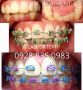 braces dental promo cubao, -- Medical and Dental Service -- Metro Manila, Philippines