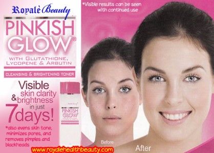 pimple remover, black heads remover, royale beauty products, -- Weight Loss -- Imus, Philippines