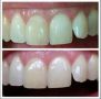 nuskin ap24 whiteningtoothpaste safetoothpaste, -- Dental Care -- Metro Manila, Philippines
