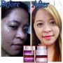 glutathione, whitening and antiaging, -- Beauty Products -- Cavite City, Philippines