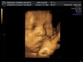 2d, 3d, 4d ultrasound in quezon city, -- Medical and Dental Service -- Metro Manila, Philippines