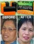 skin whitening, skin whitening soap, skin white, -- Beauty Products -- Metro Manila, Philippines