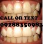veneers fixed bridge crowns flexible dentures mouth guard for tmj disorder, for teeth grinding, for sports etcrestorationsfillings prophylaxis wisdom tooth removalodontect, -- Medical and Dental Service -- Metro Manila, Philippines