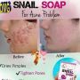 snail soap, -- Beauty Products -- Lanao del Norte, Philippines
